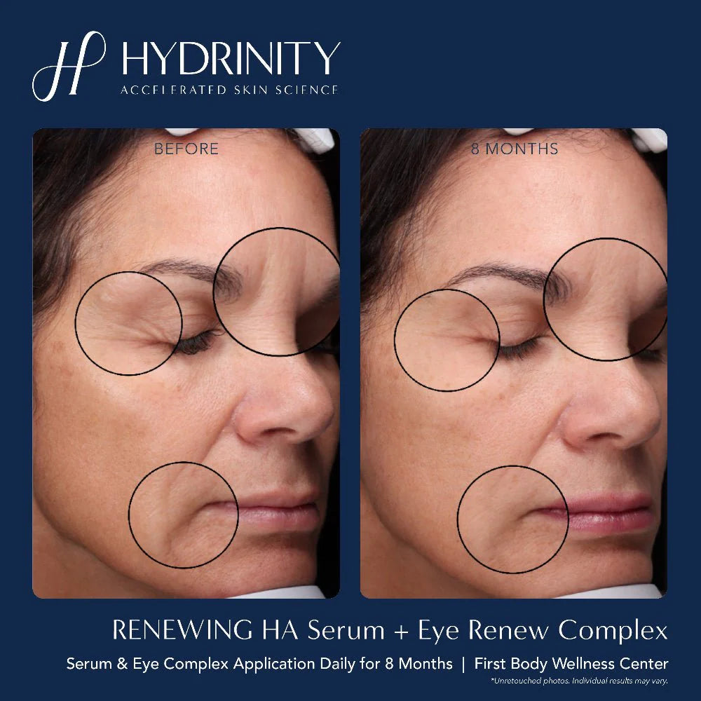 Hydrinity Renewing HA Serum